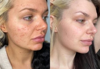 IMG_20221013_203510_567