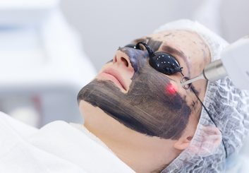 carbon skin rejuvenation laser facial