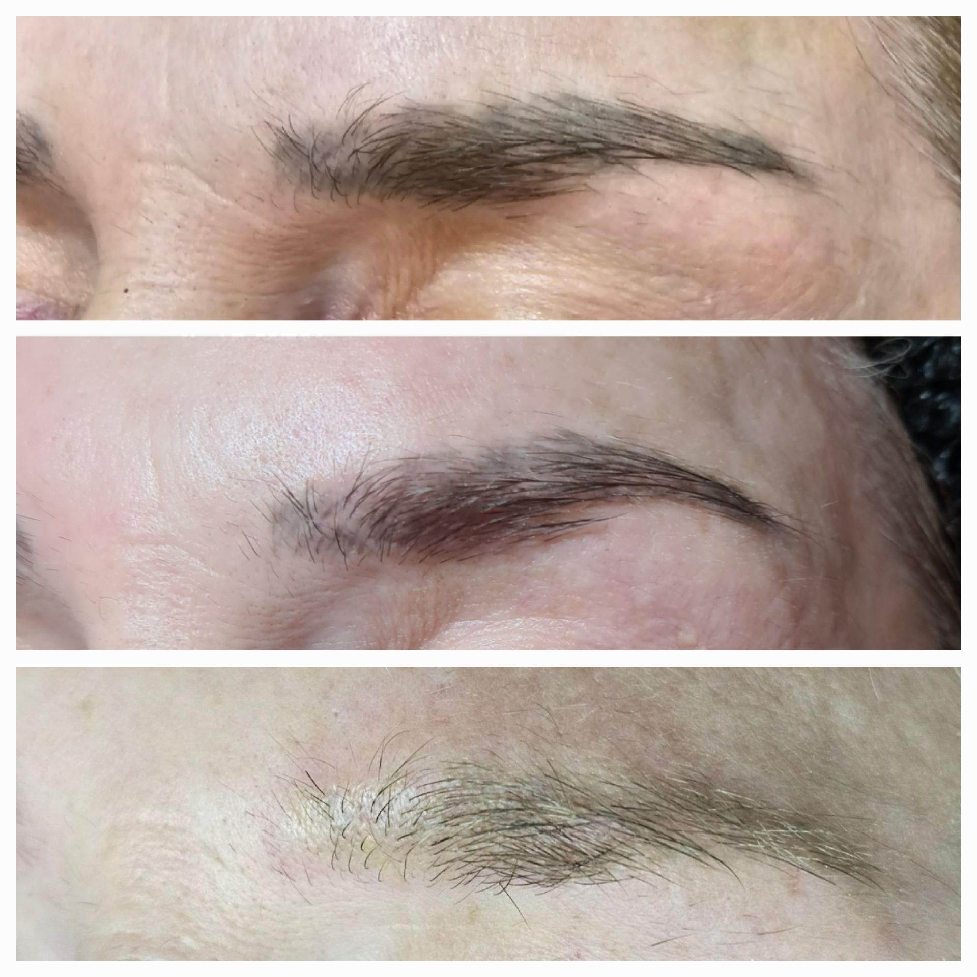 botched ink and laser removals exeter