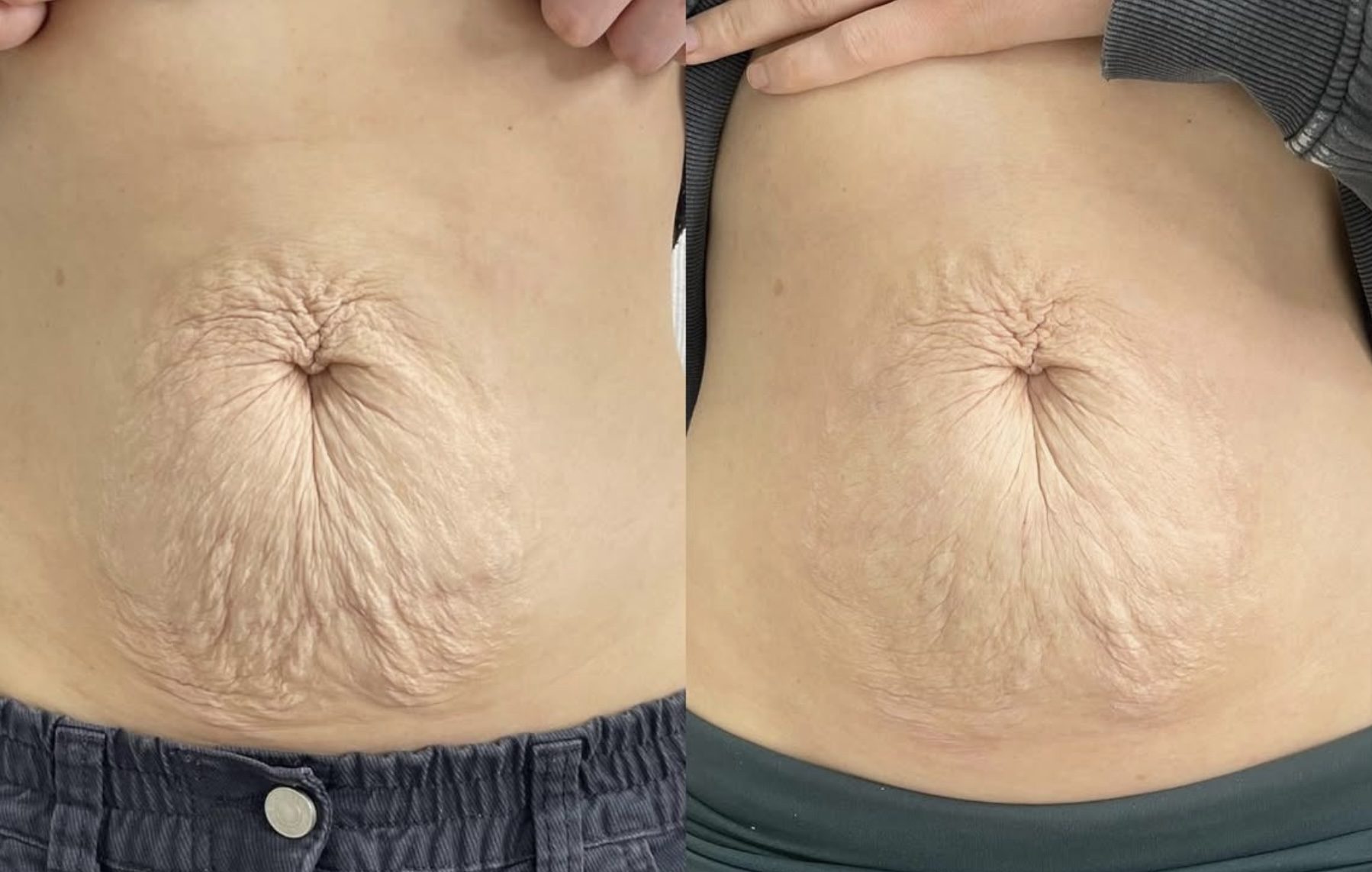 @kimberlywalker.skinandbeauty - 1