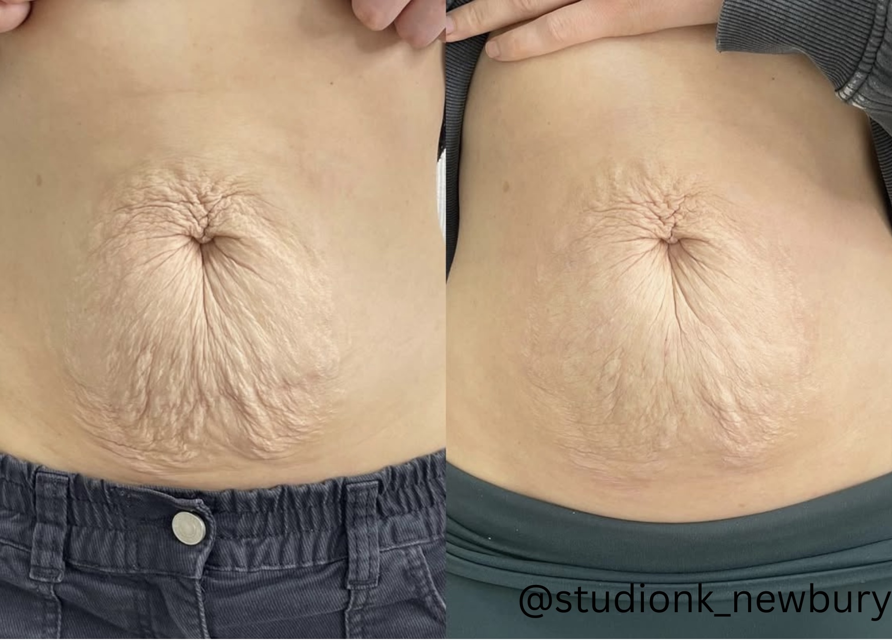 @kimberlywalker.skinandbeauty - 1