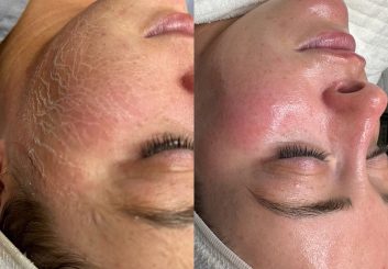 Miracle mask